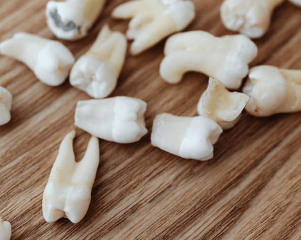 Combinação de silício e lítio pode auxiliar na regeneração do tecido que sustenta os&nbsp;dentes